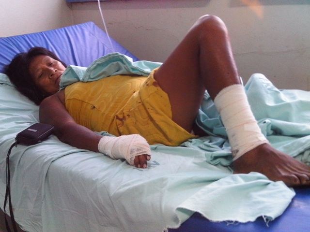Índia atacada por macaco é internada em hospital de Vilhena