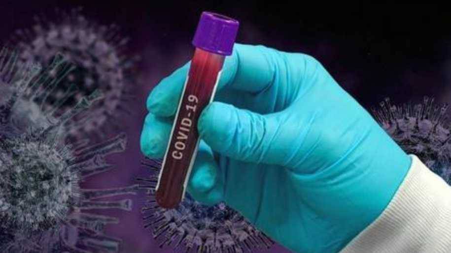 Número de pacientes recuperados da Covid-19 em Vilhena fica próximo de 65%; índice é superior à média nacional