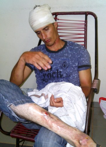 Ex-garimpeiro é agredido por gangue de menores em Vilhena