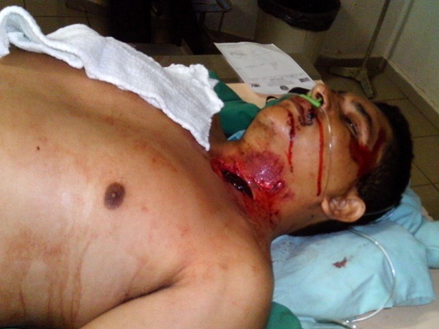 De moto, casal é atropelado e motorista foge sem prestar socorro