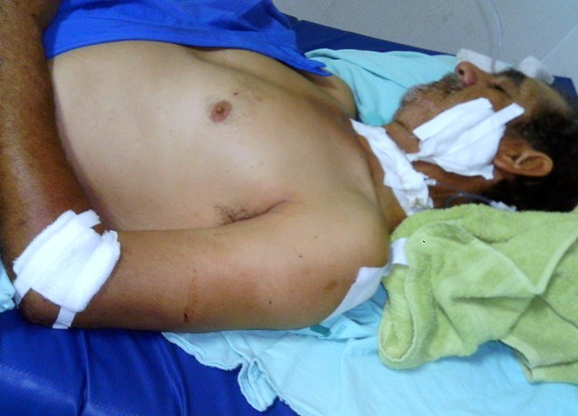 Atacado por adolescentes, vendedor ambulante leva sete facadas