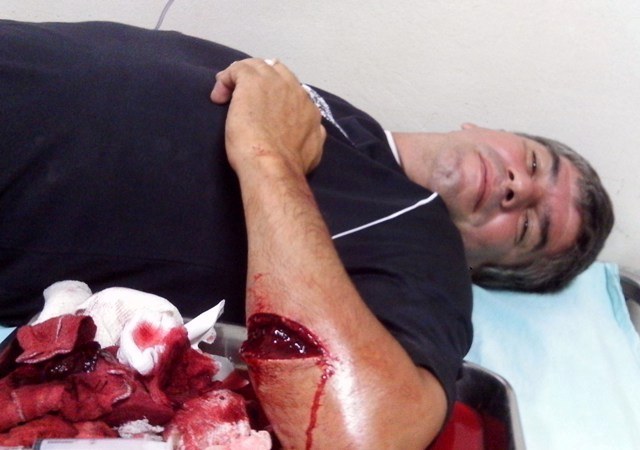 Homem que já matou a pauladas tenta decapitar sitiante em Cabixi