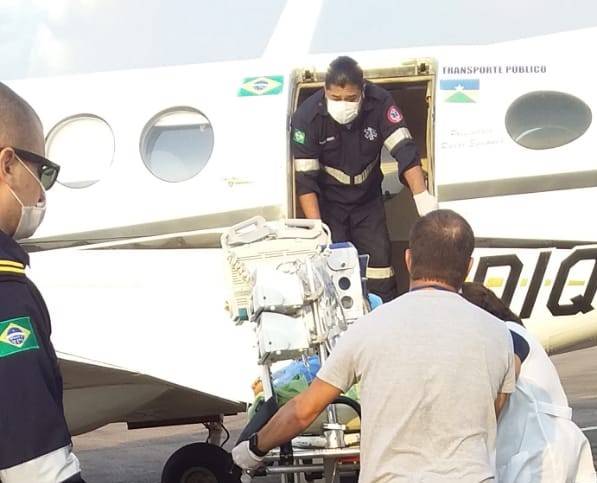 Menina vilhenense de 06 anos tem corpo atingido por fogo durante churrasco e é transferida de avião para Porto Velho