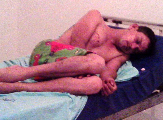 Detento é esfaqueado por companheiros na Cadeia Pública de Vilhena