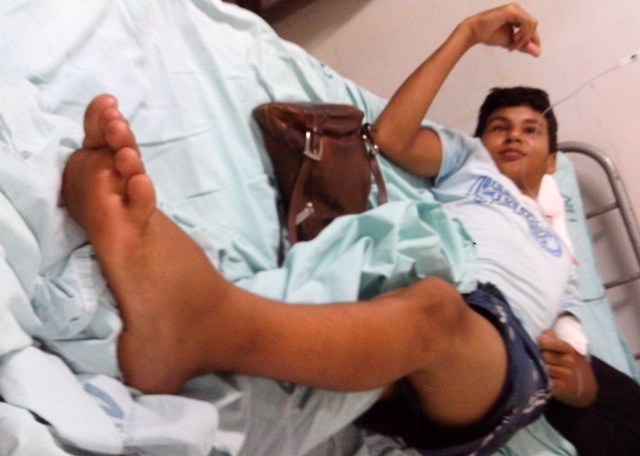 Adolescente é atacado por cobra e mãe mata animal a pauladas