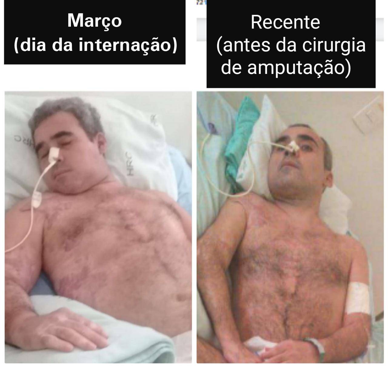 Caso de paciente de Colorado do Oeste que está comovendo Rondônia pode ter desfecho com decisão judicial e nova perícia