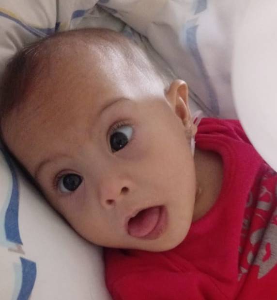 Bebê vilhenense que venceu Covid-19 e precisava de ajuda para cirurgia rara, passa pelo procedimento em São Paulo