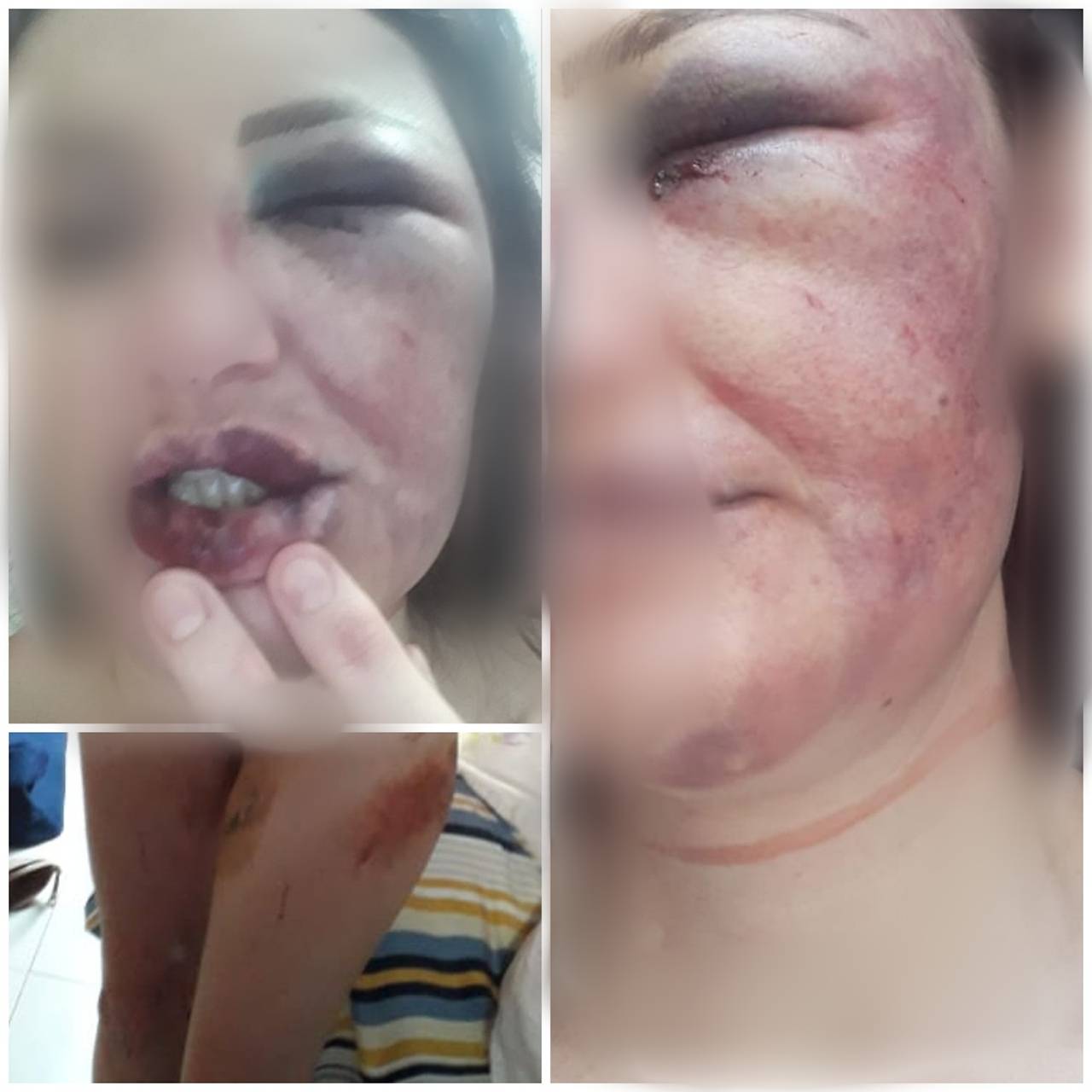 Mulher corre de roupa íntima pela rua e é alcançada pelo ex, que tenta enforcá-la em árvore; advogada relatou caso em rede social