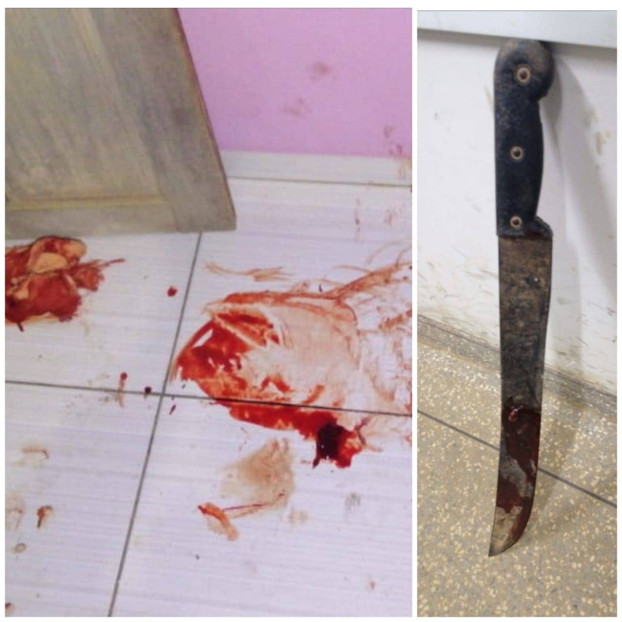 Homem é ferido a golpes de facão no Setor 12 de Vilhena; vítima deve passar por cirurgia