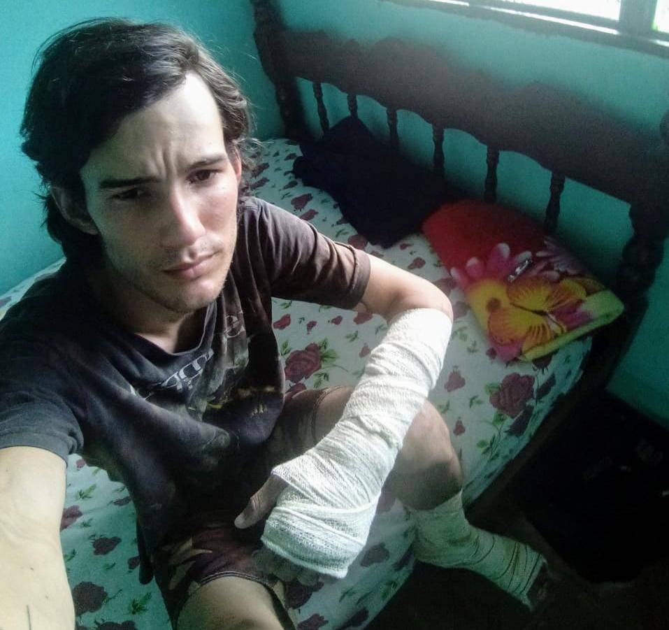 Atingido por motorista que fugiu sem prestar socorro, vilhenense pede ajuda para sobreviver; saiba como colaborar