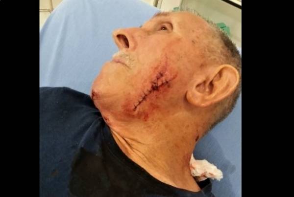 Em cidade de região, homem de 75 anos é atacado por cães da raça pit bull enquanto pedalava e caso vai parar na polícia
