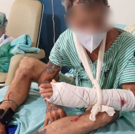 “Retalhado” a golpes de facão na área rural de Vilhena, apenado se nega a denunciar quem o atacou