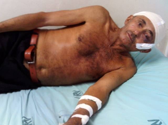 Homem de 67 anos é atacado por travesti dentro de hotel em Vilhena