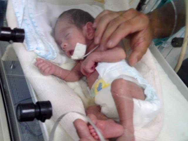 Menina que nasceu aos 5 meses deixa incubadora do Hospital Regional
