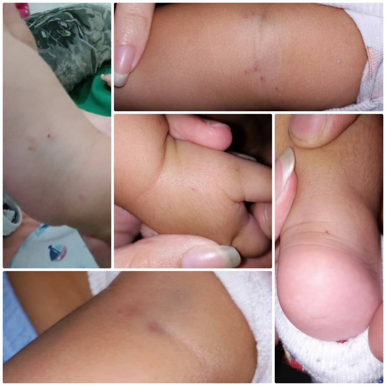 Vendo neto bebê ser “furado” em hospital, construtor aciona polícia, acaba detido e diz que servidoras distorceram sua fala