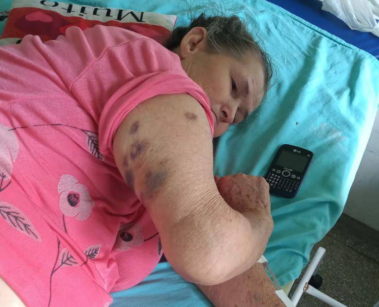 ASSISTA VÍDEO: idosas choram e denunciam “abandono” em hospital; rapaz acidentado acabou perdendo parte da perna