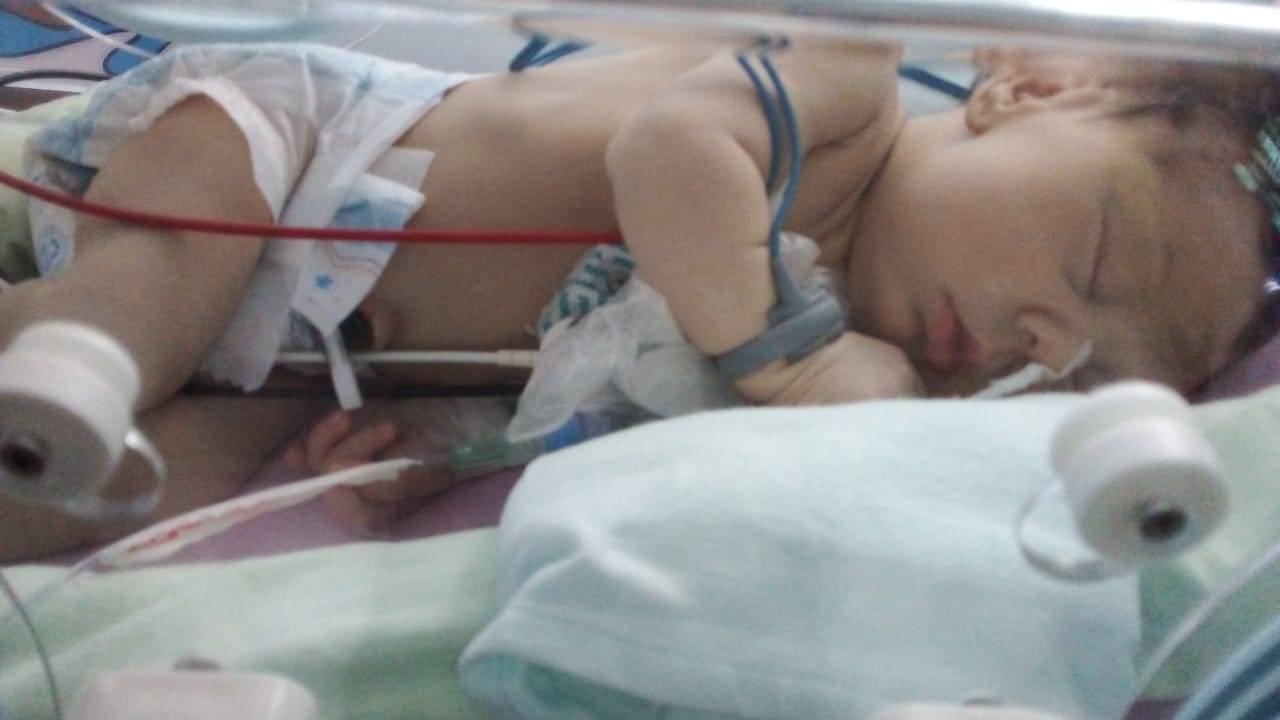 Com apenas 16 dias de vida, bebê de Colorado do Oeste precisa fazer 3 cirurgias em São Paulo; pais pedem ajuda