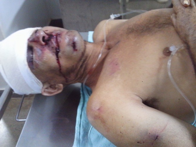 Braçal tenta separar briga de irmãos e é agredido pelos briguentos