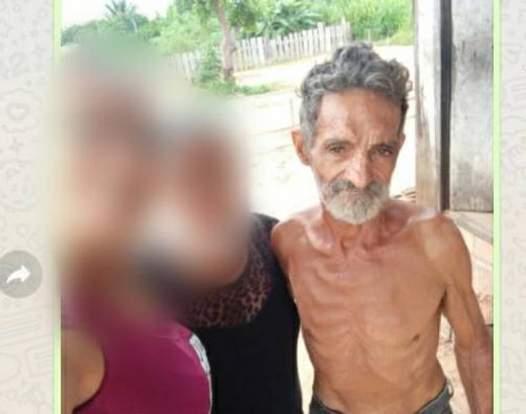 Preso sem culpa, ex-morador de rua morre em hospital de Vilhena sem realizar o sonho de reencontrar a filha