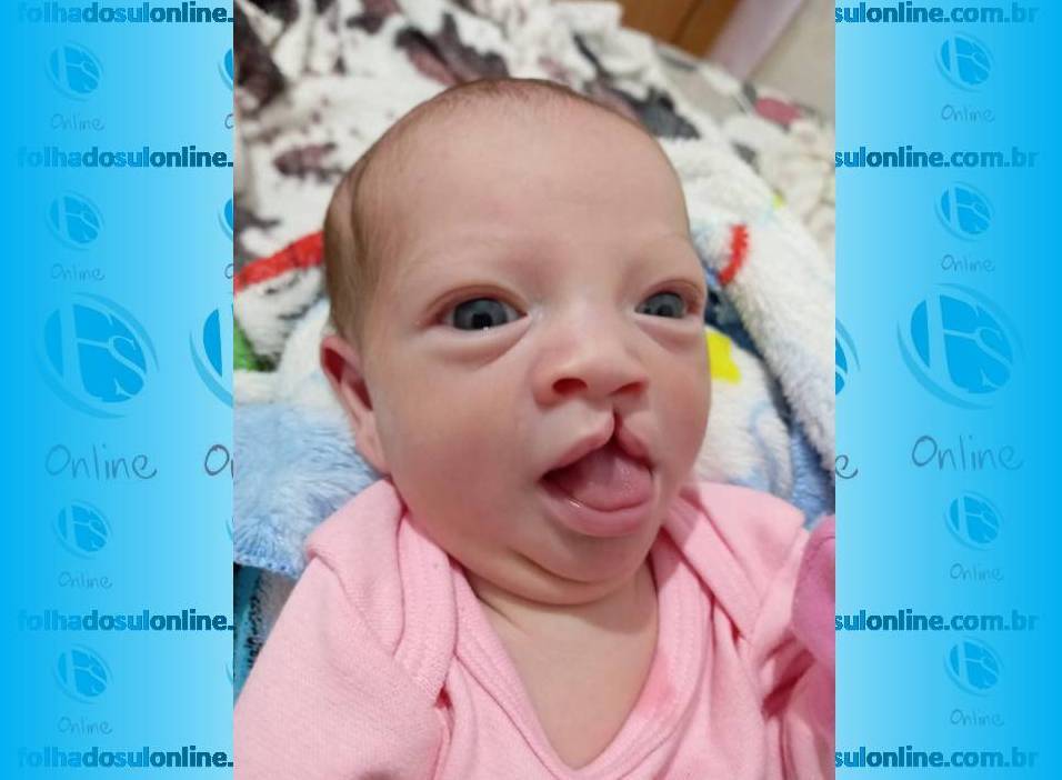 Família de garotinha que nasceu com má formação labial precisa de ajuda para pagar cirurgia de R$ 22 mil; veja como contribuir