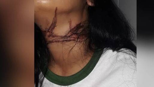 Rapaz de 22 anos desfere facada no pescoço da esposa na frente dos três filhos e depois tenta conter sangramento