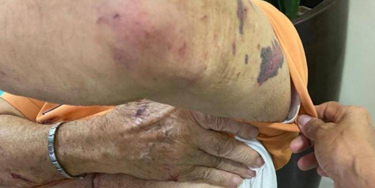 Idoso é violentamente espancado na zona rural de Vilhena; assaltantes disseram ter agido a mando do irmão da vítima