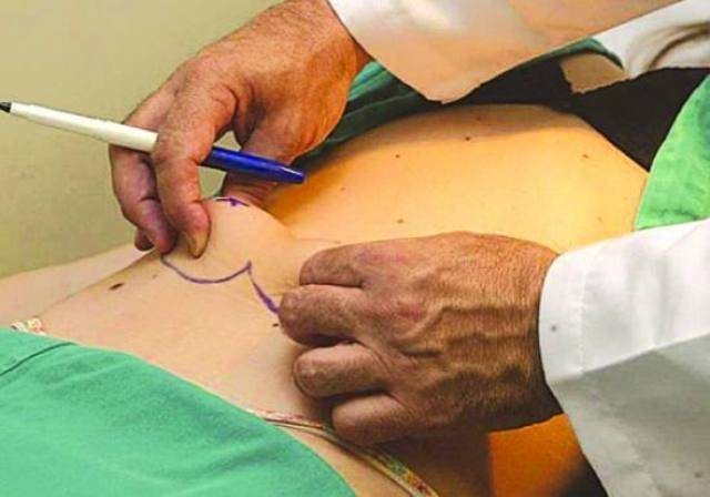GAZIN FAZ CONSÓRCIO DE CIRURGIAS PLÁSTICAS