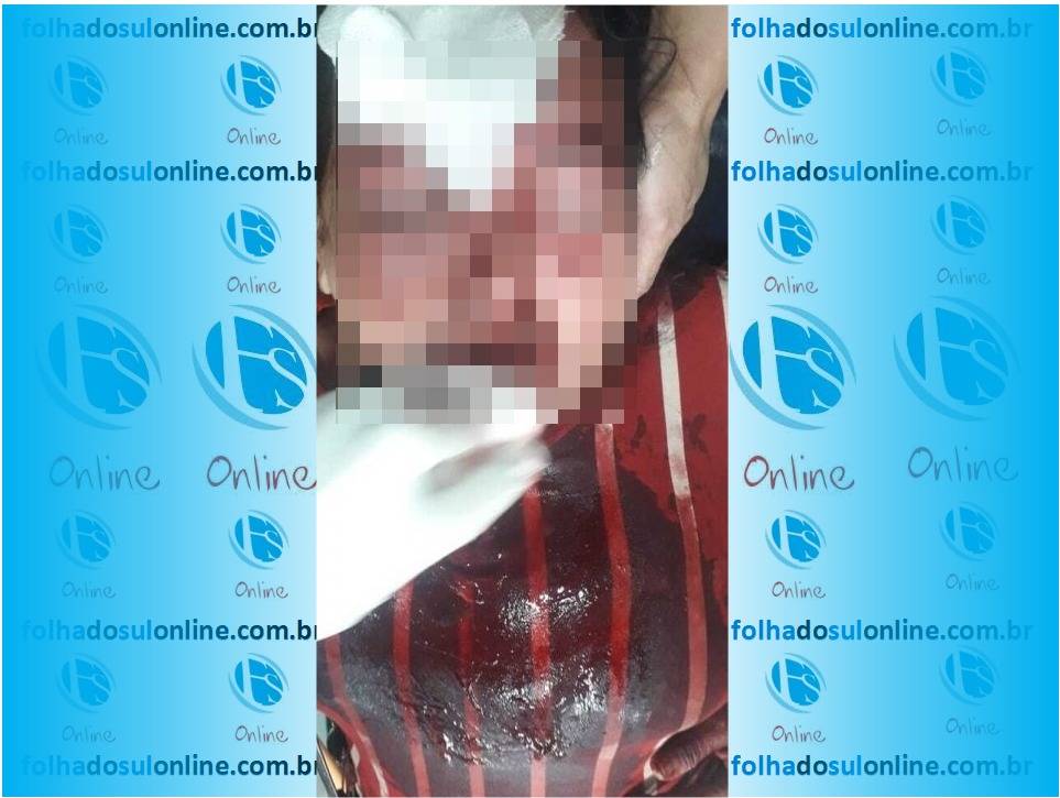 Espancada violentamente pelo marido, mulher é salva da morte pelos gritos do vizinho; agressor está foragido