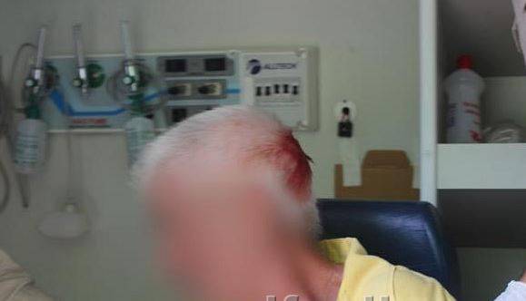 Adolescente de 16 anos com transtornos psiquiátricos tenta matar o próprio pai, de 62, a golpe de enxada