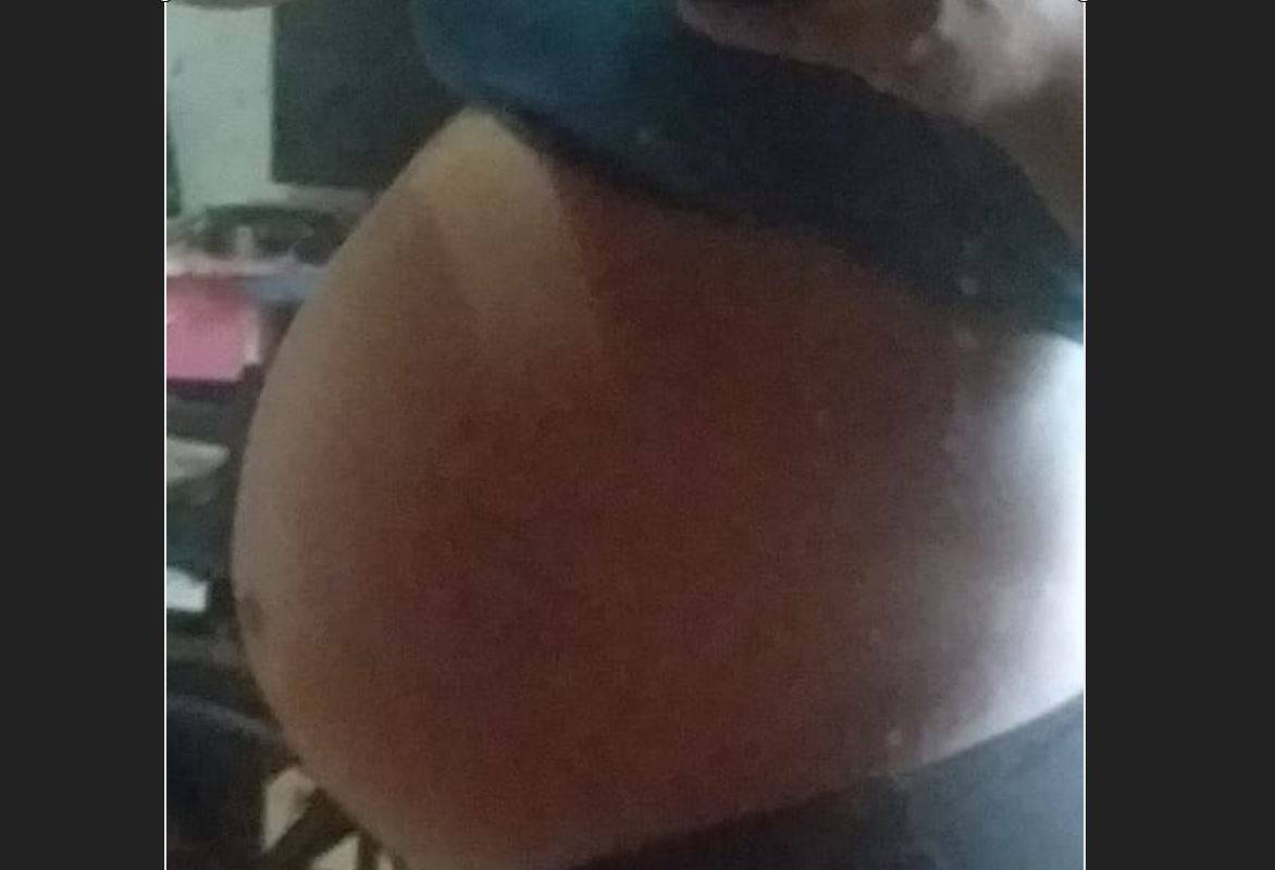 Grávida de 18 anos diz que está sendo forçada a ter bebê em parto normal, mesmo preferindo cesariana