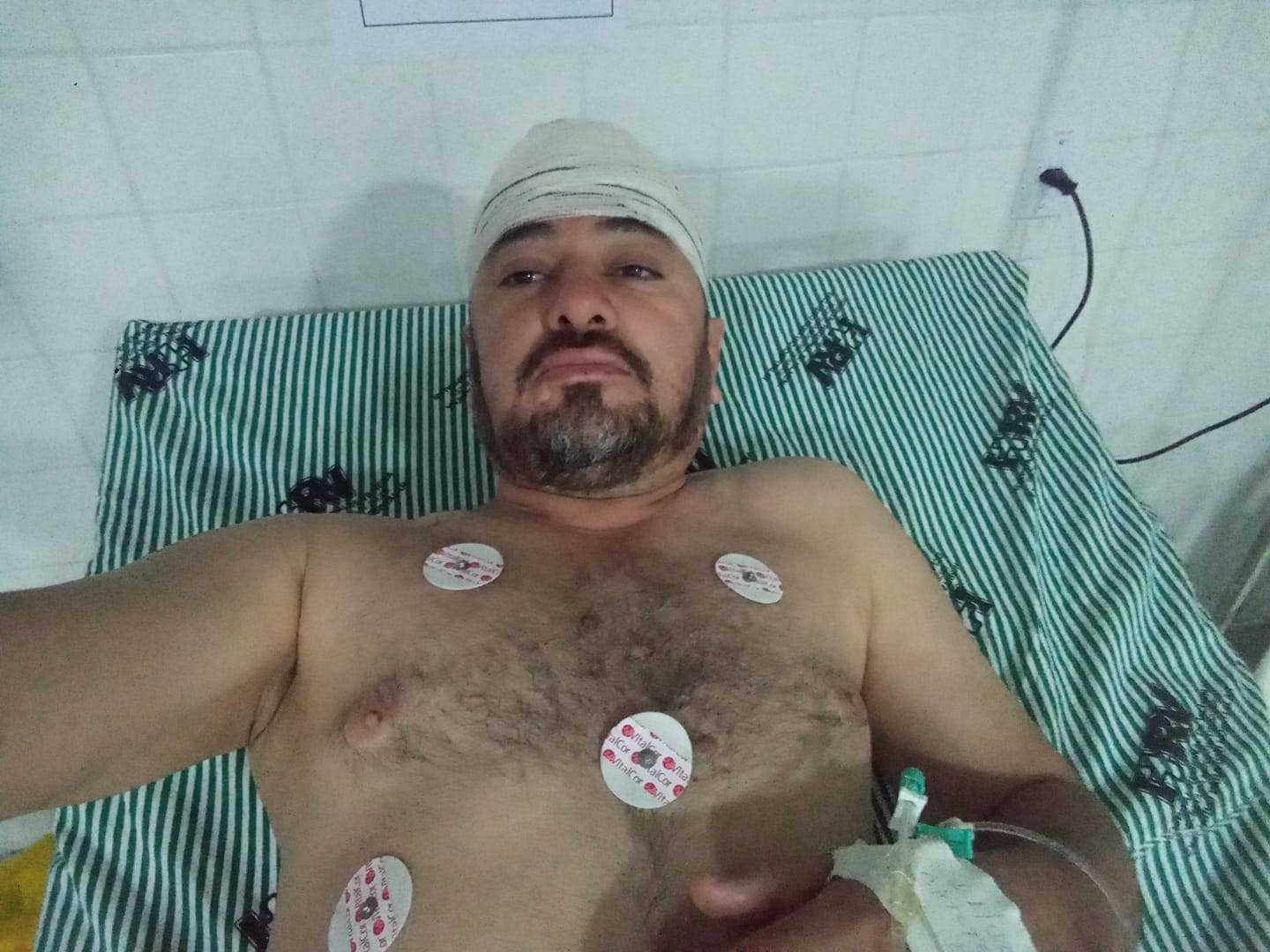 Tentando combater incêndio em madeireira, ex-vereador sofre acidente e é transferido de Cabixi para Vilhena