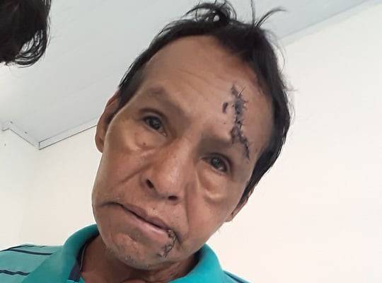 Idoso indígena que sobreviveu a ataque de onça teve premonição antes de enfrentar o felino em Chupinguaia