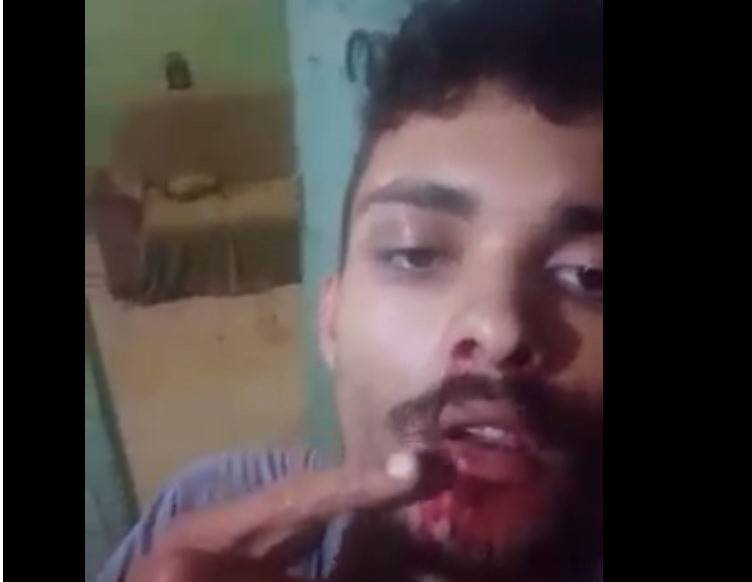 ASSISTA: sangrando, serralheiro de 24 anos publica vídeo no Facebook e diz ter sido agredido por policial militar, em Vilhena