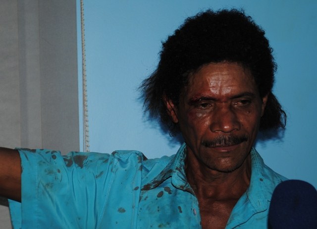 Cantor com três discos gravados briga com companheiro de “cachaçada”