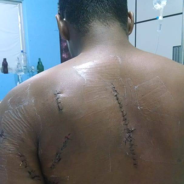 Marceneiro que sobreviveu a 15 facadas tinha dívida a receber; pivô do violento ataque continua foragido, mas ativo no Facebook