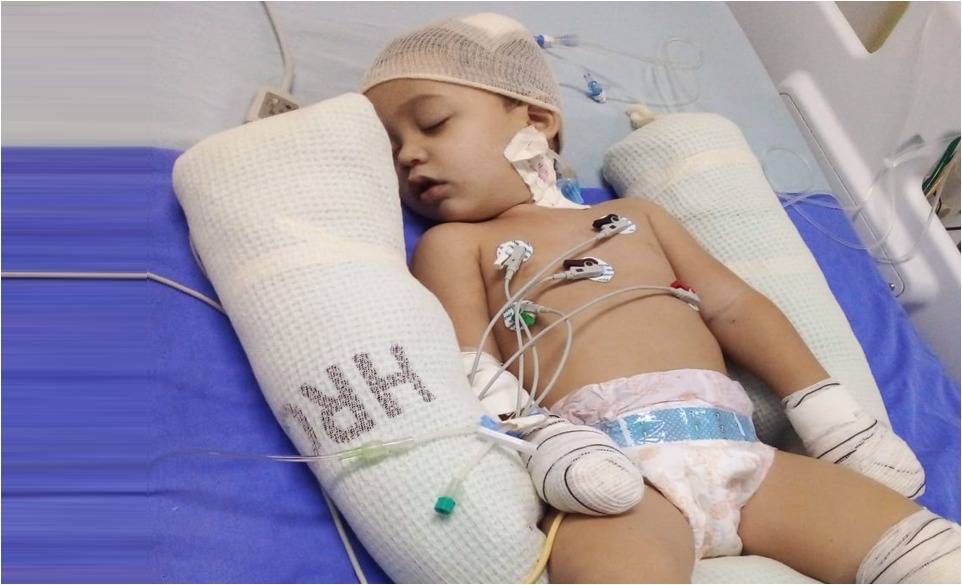 Bebê de 02 anos baleado na cabeça em Vilhena e transferido para hospital de Cacoal sobrevive e se recupera bem