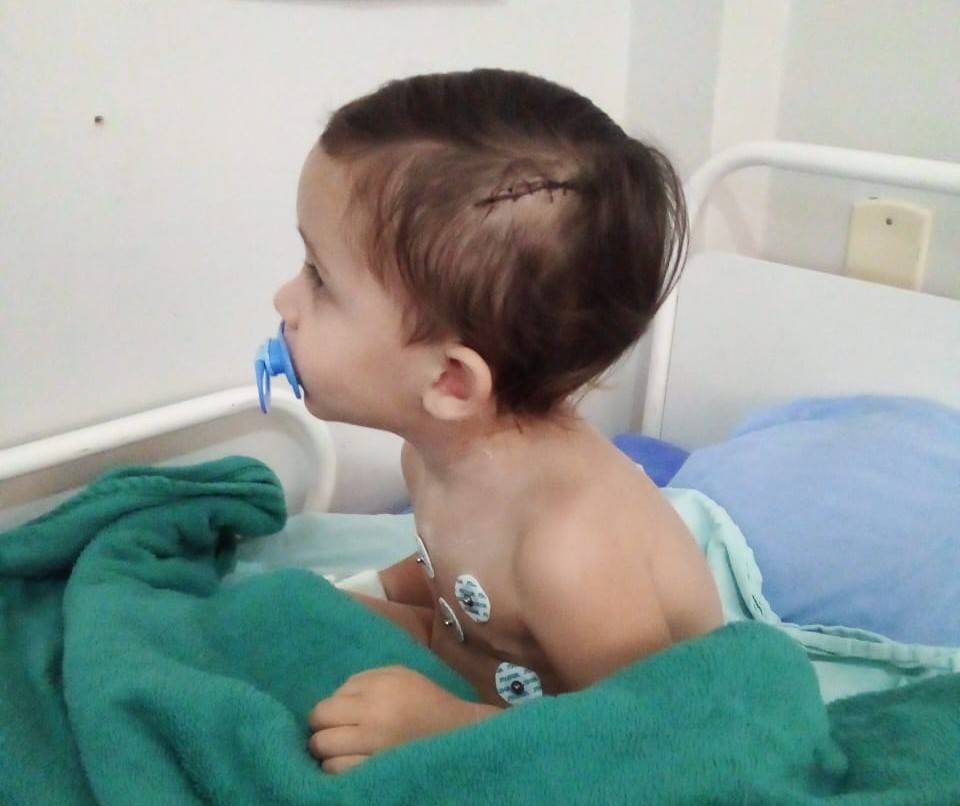 ASSISTA: vídeo mostra garotinho de 02 anos baleado na cabeça em Vilhena já recuperado e andando em hospital