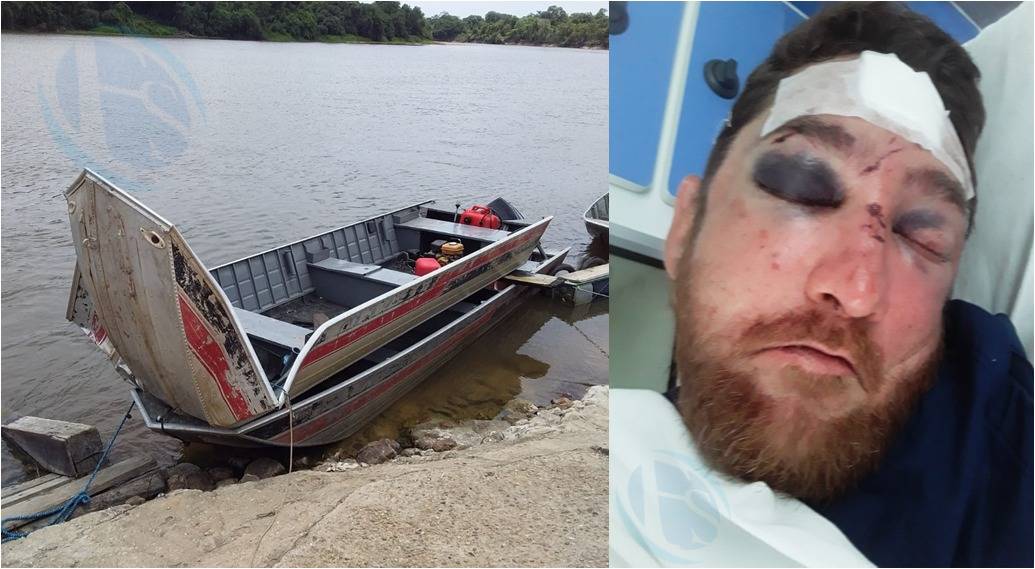 Pescador sofre ferimentos graves após barco bater em barranco no rio Guaporé, em Pimenteiras; amigos fazem campanha