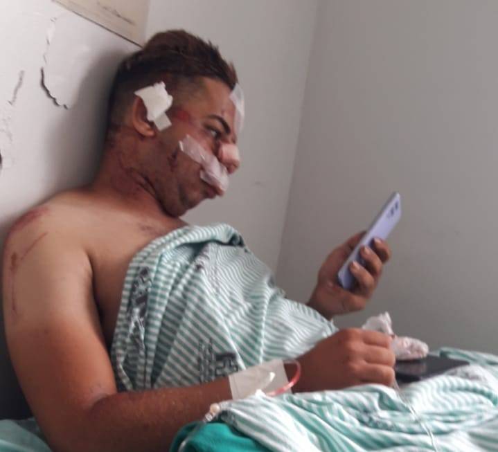 Cabeleireiro de 20 anos atropelado em Cerejeiras é operado em Vilhena e escreve: “Deus fez um milagre na minha vida...”