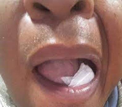 Caminhoneiro que saiu de Vilhena "engole" cocaína para fugir de flagrante e tem overdose em cidade de Mato Grosso