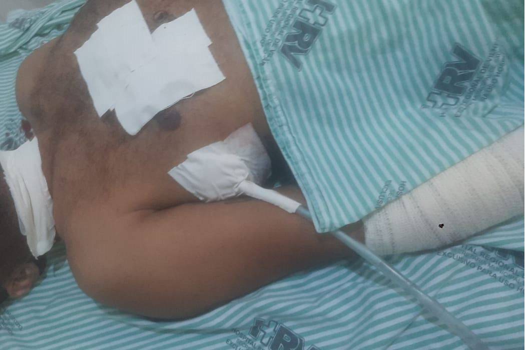 Homem baleado em Vilhena passa por cirurgia; autor dos disparos teria espancado garoto de 18 anos e ameaçado de morte a enteada