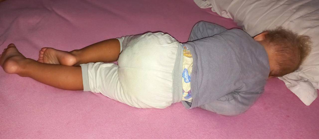 Com apenas 1 ano e 9 meses, bebê testa positivo para Covid-19 e mãe critica atendimento em Vilhena