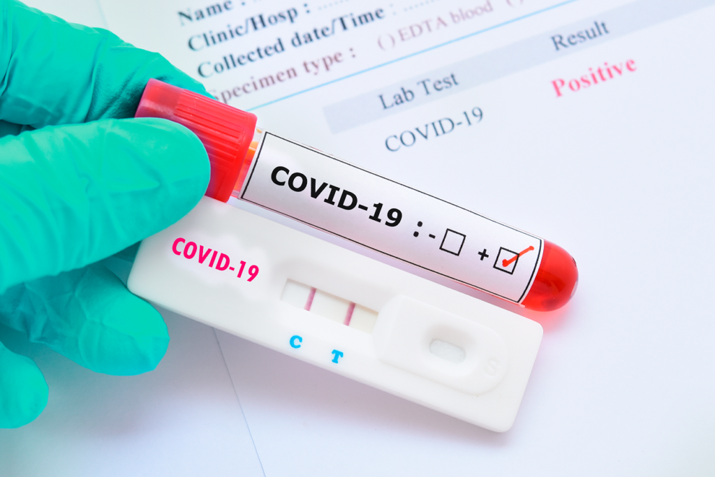 Vilhena registrou nas últimas 24 horas 91 novos casos de covid-19; média móvel diária é de 95 casos