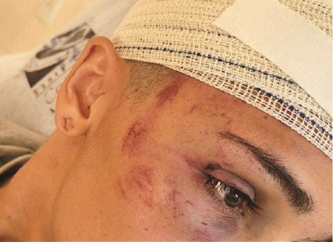 Garoto de 19 anos é espancado por ladrões e tem celular roubado; vizinho achou que era “briga de adolescentes”