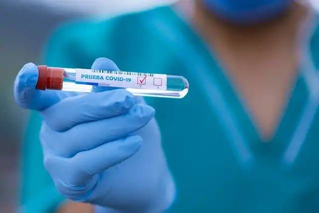 Vilhena registra 60 novos casos de Covid-19 no intervalo de 24 horas; média móvel de casos apresenta que de 10%