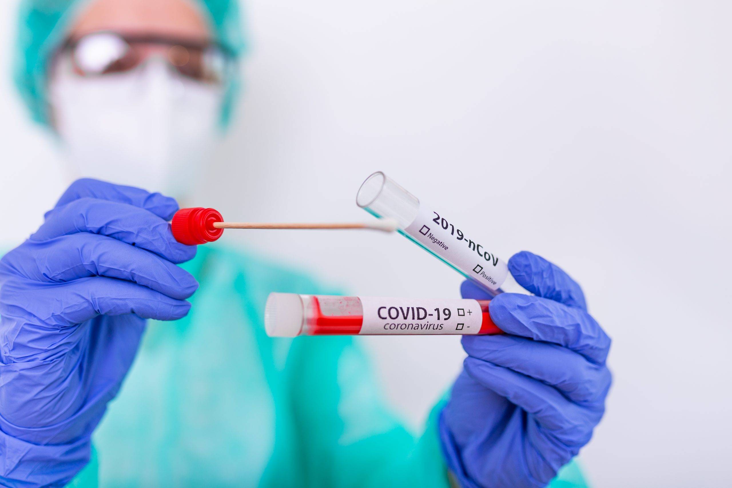 Vilhena registra 46 novos casos de Covid-19 em 24 horas; média móvel diária é de 60 casos