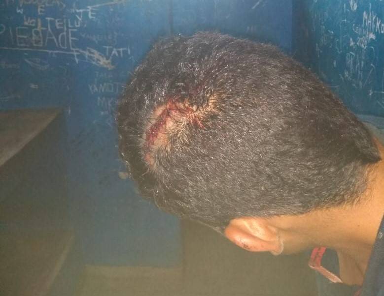 Flagrado furtando fiação em chácara, adolescente ataca dono da propriedade e lava paulada na cabeça