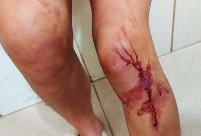 Em Vilhena, mulher é sequestrada, torturada e ameaçada para retirar queixa contra ex-marido preso por violência doméstica