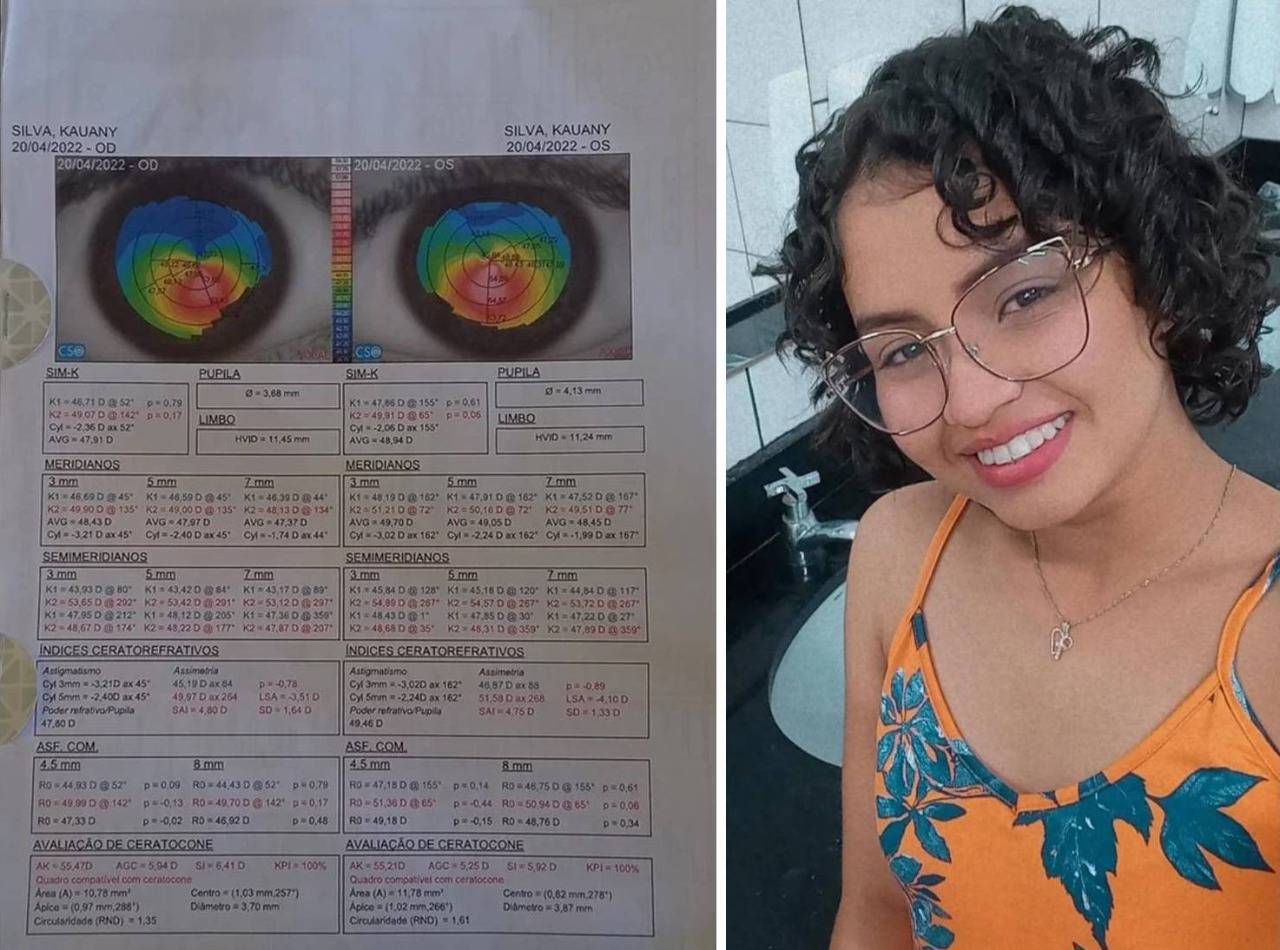 Família de garota vilhenense de 18 anos deflagra campanha para evitar que ela perca a visão; saiba como ajudar