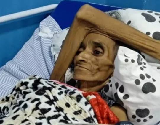 Justiça garante internação de ex-moradora de Chupinguaia abusada na infância e vivendo há meio século sem documentos